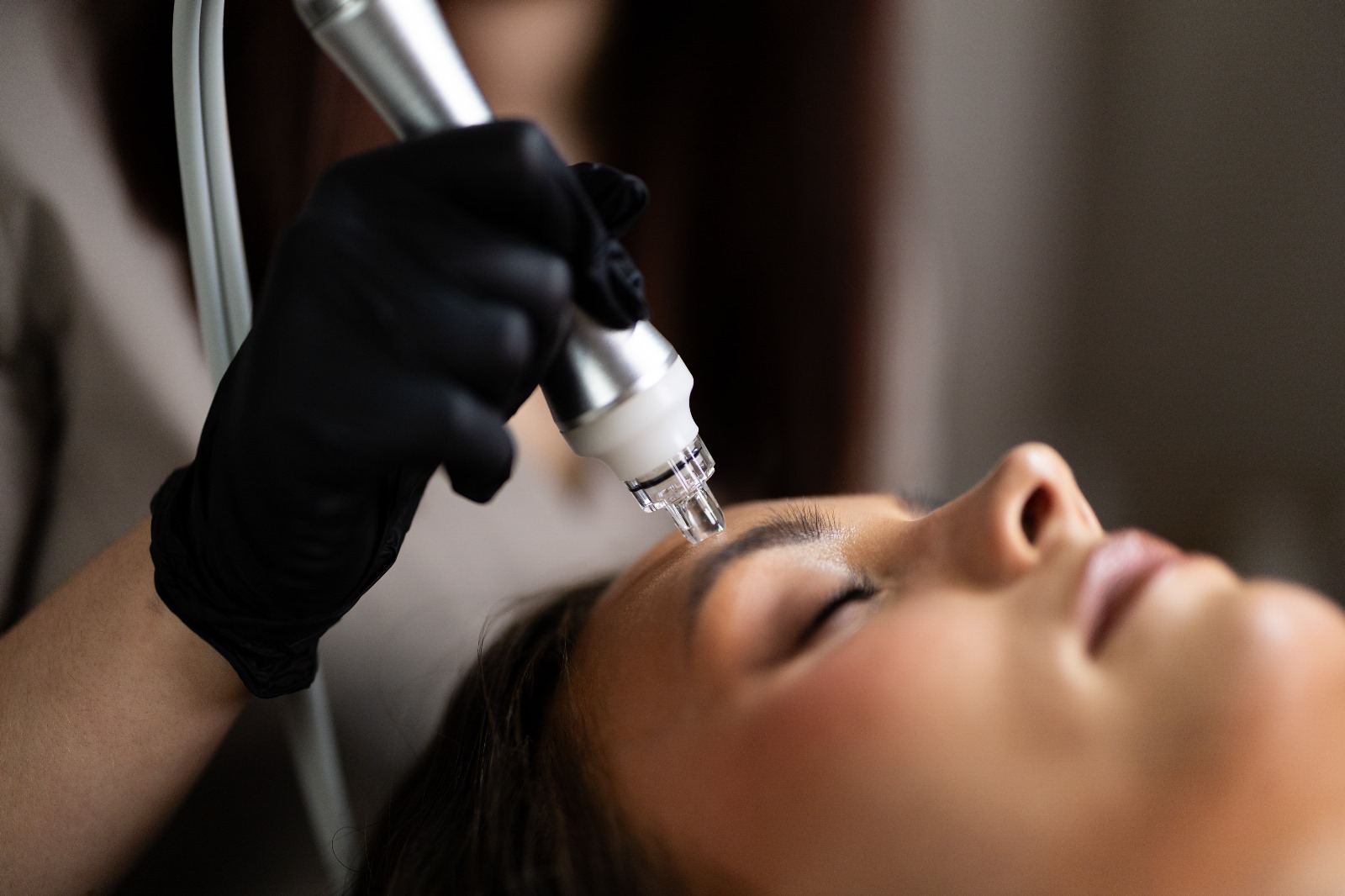 Wieloetapowe oczyszczanie wodorowe twarzy w Ann Marie Beauty Clinic Częstochowa